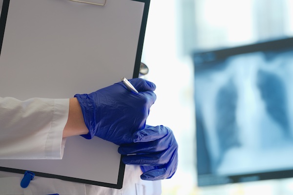 A pleural mesothelioma trial doctor holds a clipboard showing 100% survival of study patients one year after treatment. The clipboard and the doctor's gloved hands are in the foreground on the left, and an out-of-focus chest x-ray is in the background on the right.